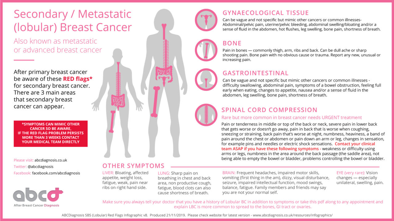 Diagnosis Lobular Breast Cancer Uk 8728