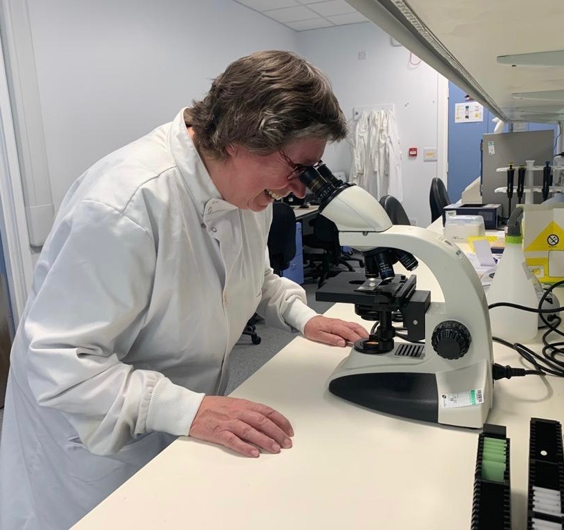 Woman in white lab coat looking into a microscope during the visit by patients to Edinburgh University to discuss lobular breast cancer research