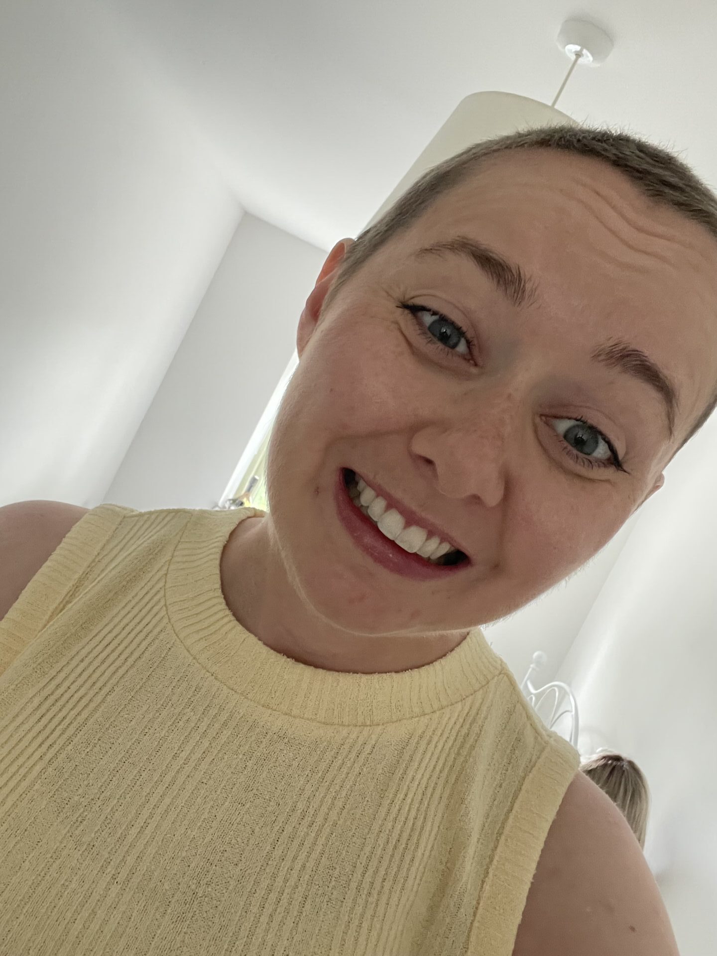 Georgie after treatment for Lobular Breast Cancer